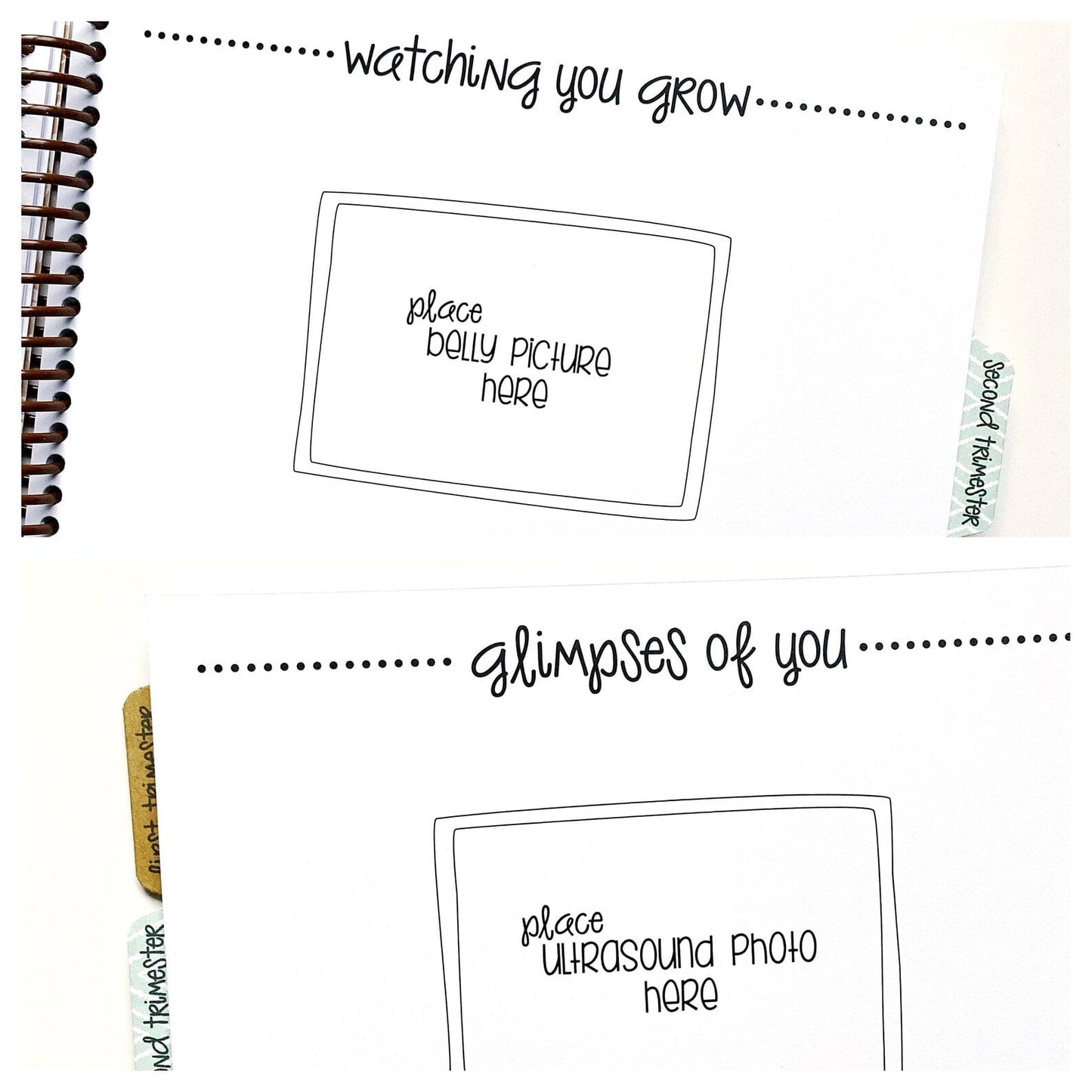 twin pregnancy journal