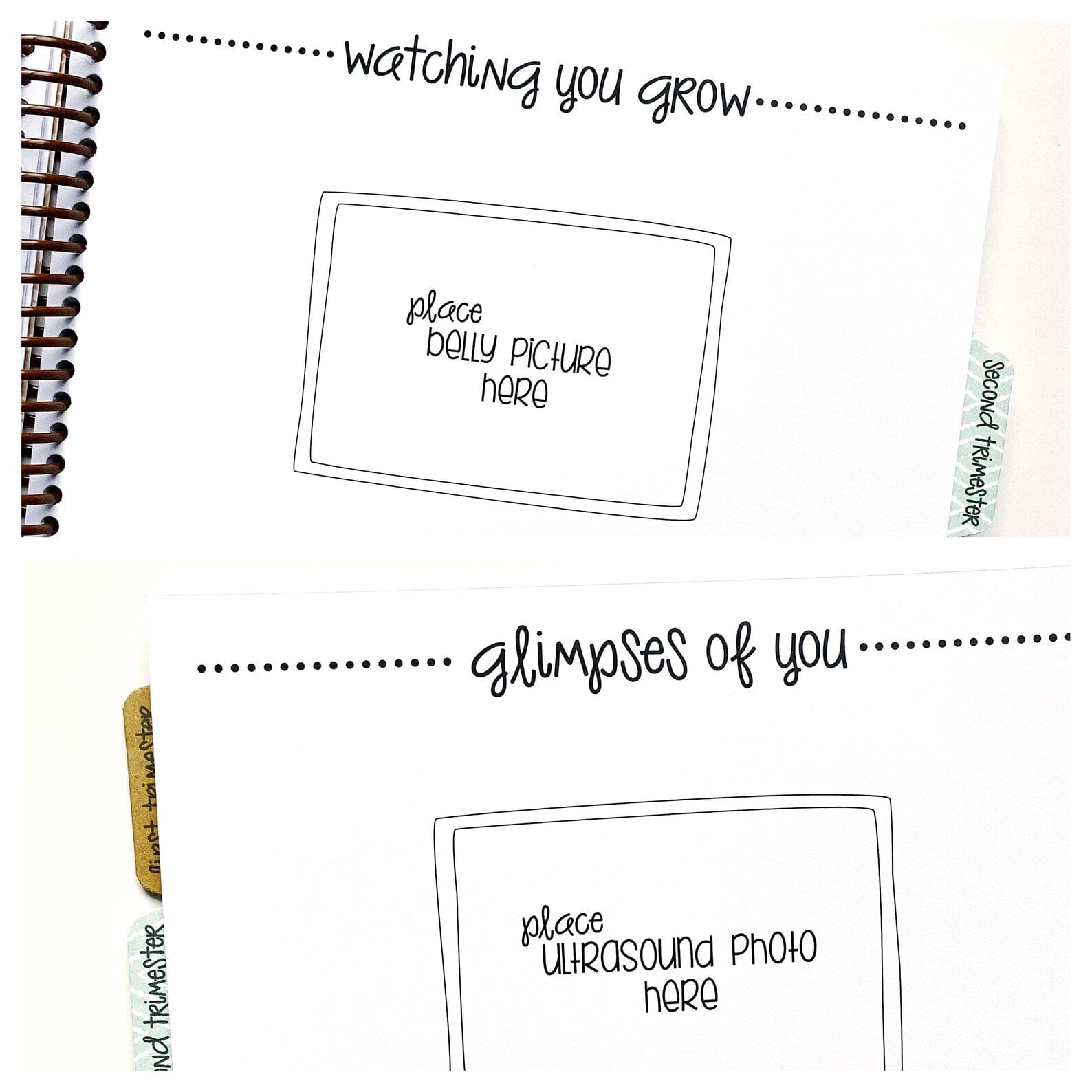 twin pregnancy journal
